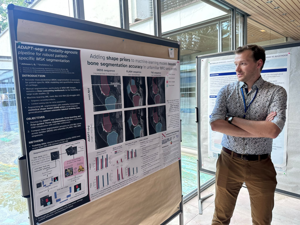 A researcher stands with arms crossed beside a scientific poster presentation titled "ADAPT-seg" about medical imaging and bone segmentation. The poster includes MRI scan images showing cross-sections of bones, along with charts, graphs, and technical diagrams explaining the research methodology for patient-specific musculoskeletal (MSK) segmentation using machine learning models.