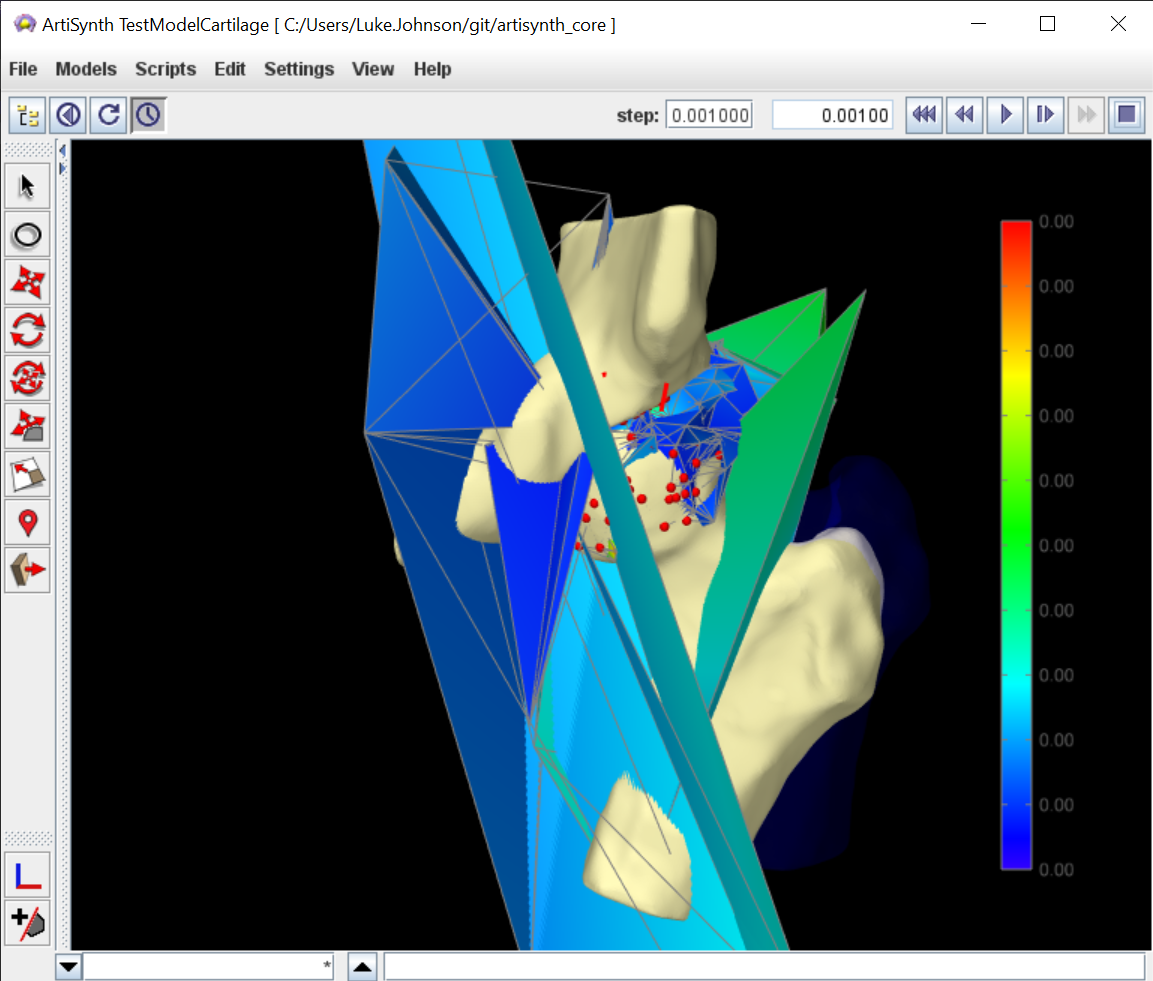 A screenshot of a failed hip joint simulation. The bones of the pelvis and the femur are in about the right place, but the cartilage finite element mesh has exploded into a jagged and colourful sculpture.
