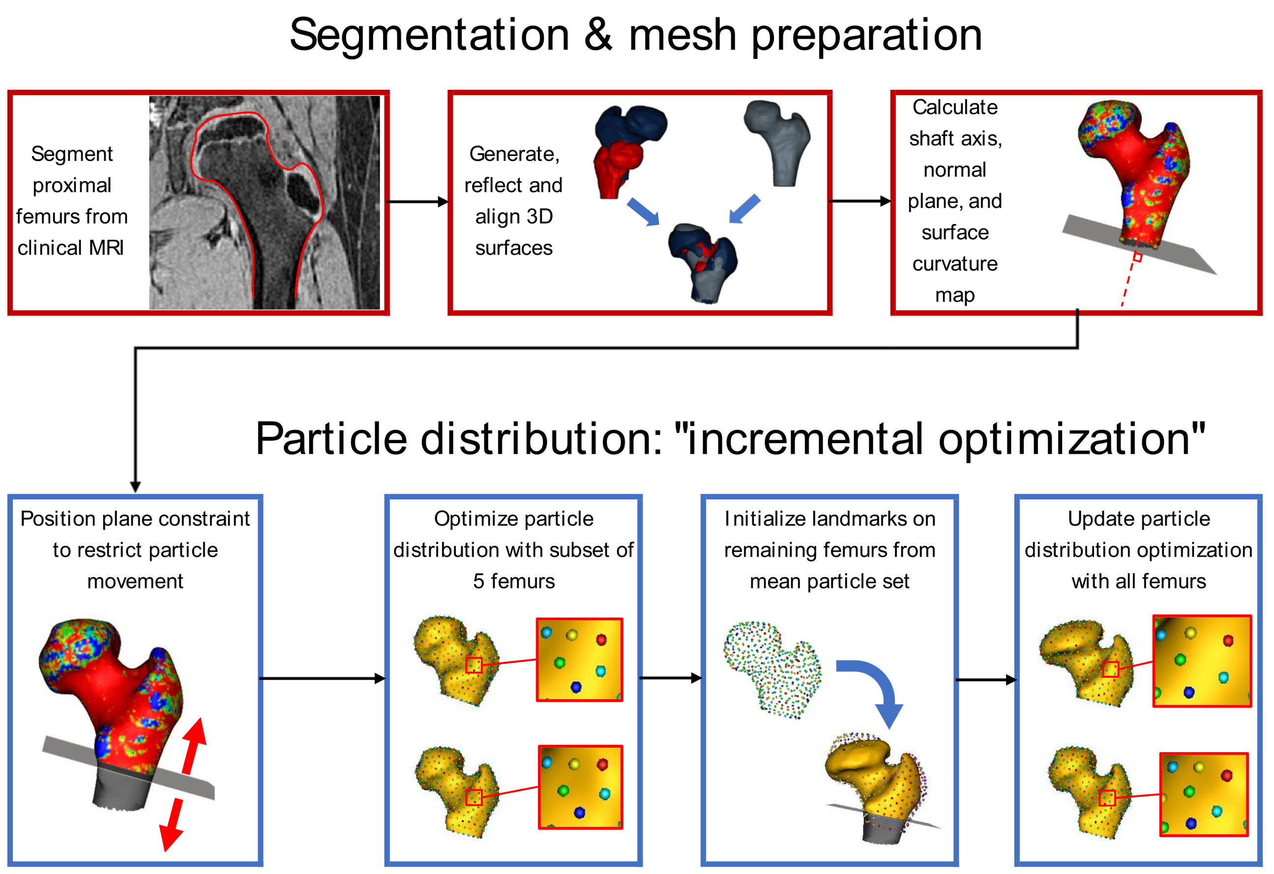 Our framework provides a step-by-step guide for making statistical shape models of Legg–Calvé–Perthes disease deformity.